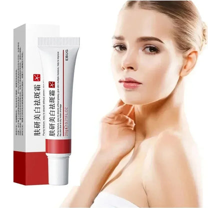 Whitening Freckle Cream Niacinamide Remove Dark Spot Cream Anti Freckle and Aging Cream Fade Pigmentation Melasma Skin