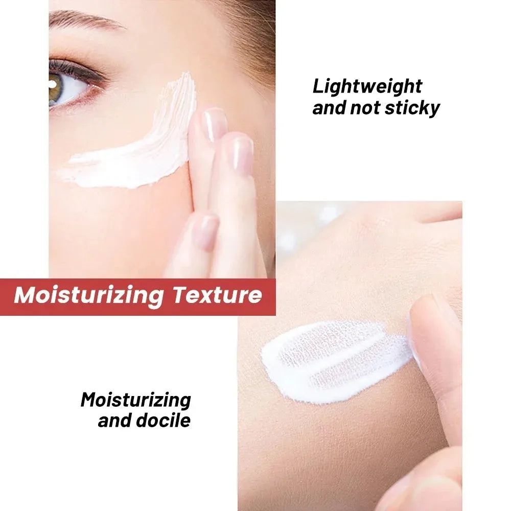 Whitening Freckle Cream Niacinamide Remove Dark Spot Cream Anti Freckle and Aging Cream Fade Pigmentation Melasma Skin