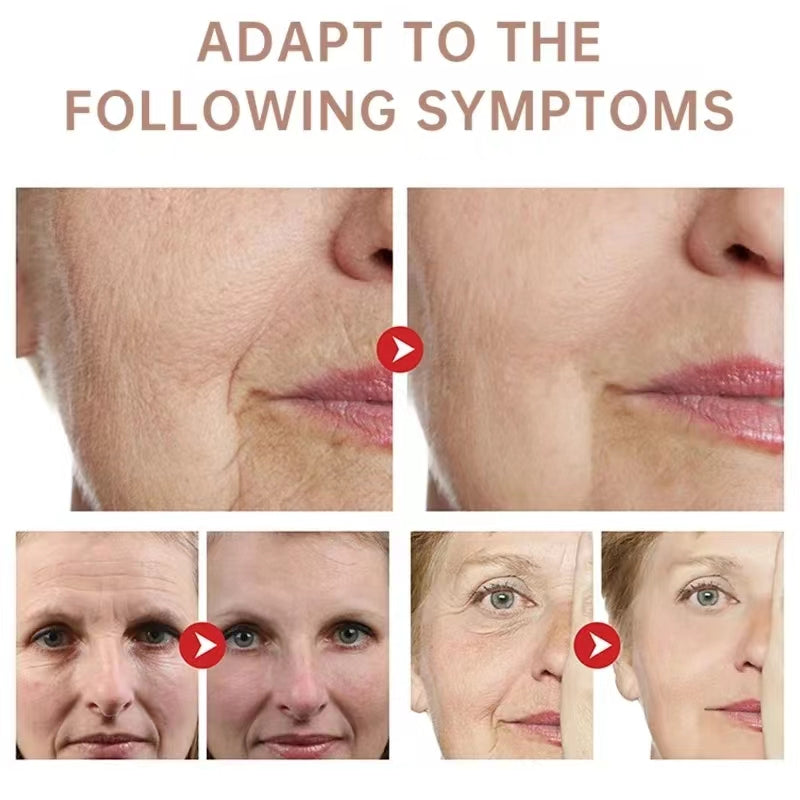 Collagen Neck Cream Eliminate Neck Wrinkle Lines Lifting Whitening Tighten Double Chin Anti-age Rejuvenation Skin Care Cream (Available)