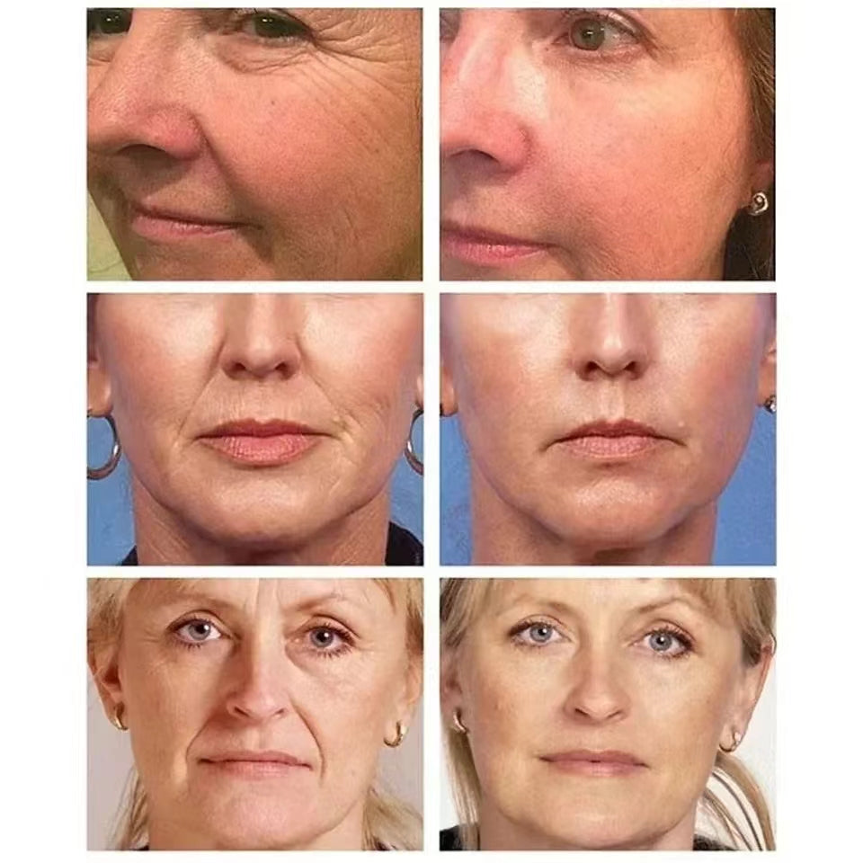 Collagen Neck Cream Eliminate Neck Wrinkle Lines Lifting Whitening Tighten Double Chin Anti-age Rejuvenation Skin Care Cream (Available)