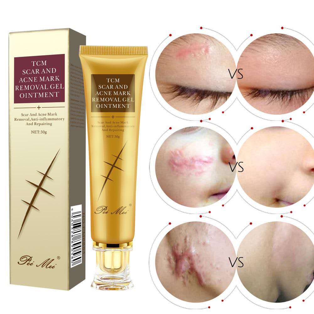 TCM Scar Acne Mark Removal Gel Ointment, 30g